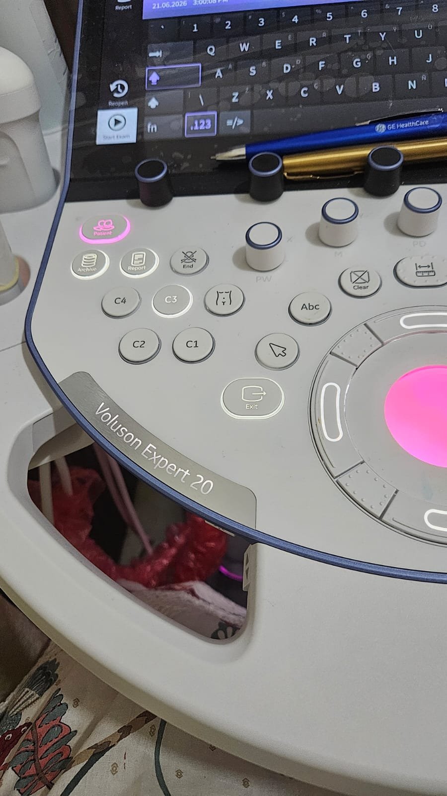 Control panel of the GE Voluson Expert 20 at Dr. Aditi’s Fetal Medicine Centre, Prayagraj